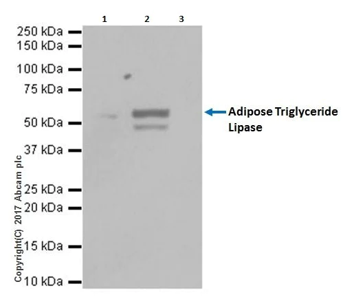 Immunoprecipitation - Anti-Adipose Triglyceride Lipase antibody [EPR19650] - BSA and Azide free (AB240381)