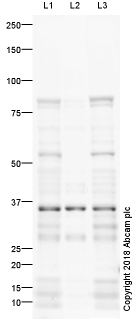 Western blot - Anti-Adipose Triglyceride Lipase (phospho S406) antibody (AB135093)