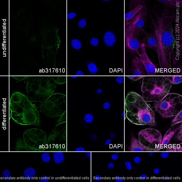 Immunocytochemistry/ Immunofluorescence - Anti-Adipose Triglyceride Lipase (phospho S406) antibody [EPR27159-29] (AB317610), expandable thumbnail
