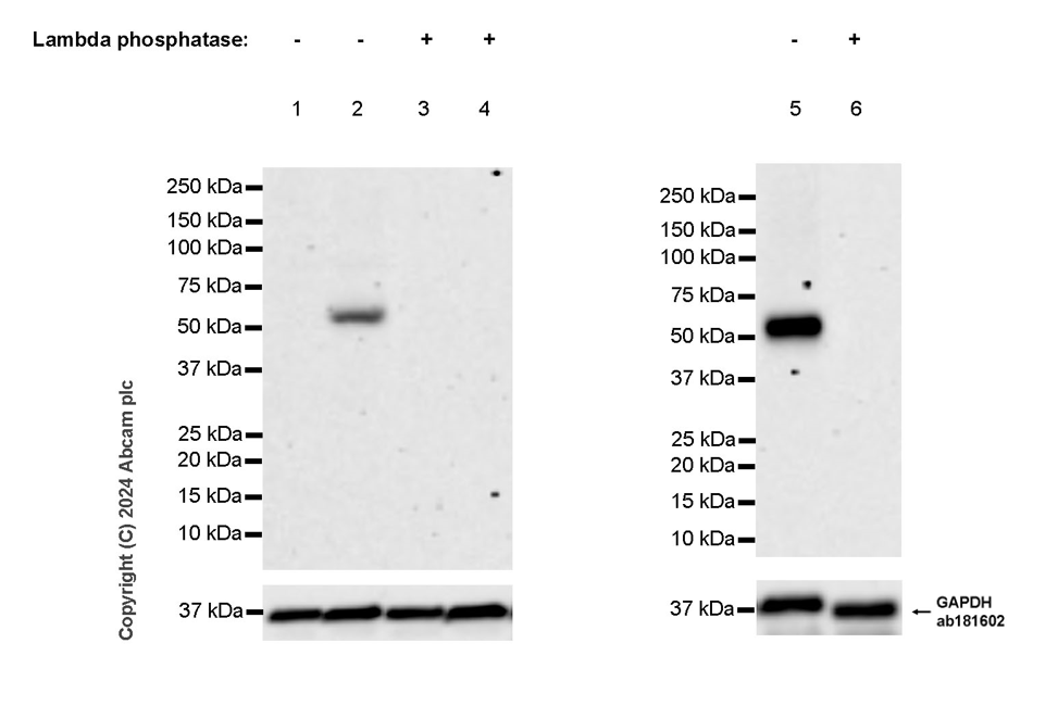 Western blot - Anti-Adipose Triglyceride Lipase (phospho S406) antibody [EPR27159-29] (AB317610), expandable thumbnail