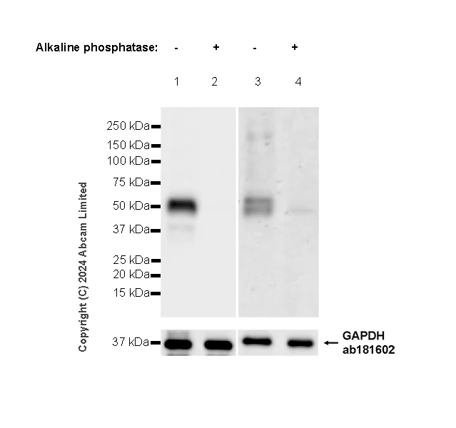 Western blot - Anti-Adipose Triglyceride Lipase (phospho S406) antibody [EPR27159-29] (AB317610)