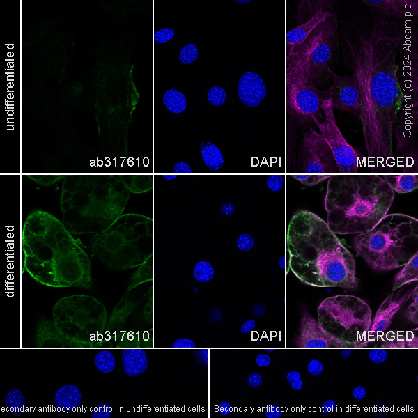 Immunocytochemistry/ Immunofluorescence - Anti-Adipose Triglyceride Lipase (phospho S406) antibody [EPR27159-29] - BSA and Azide free (AB317611)