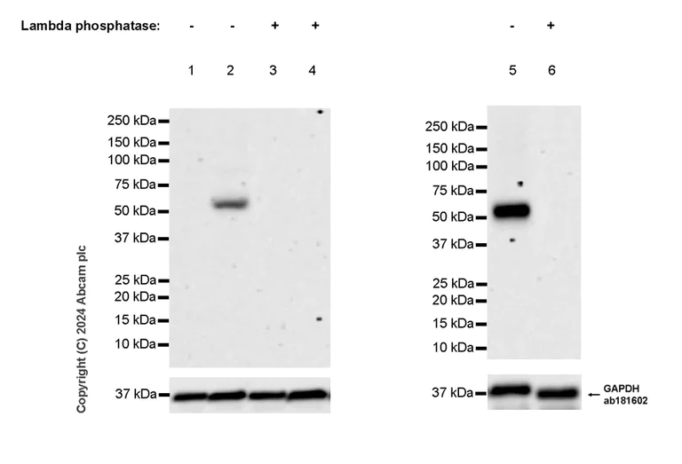 Western blot - Anti-Adipose Triglyceride Lipase (phospho S406) antibody [EPR27159-29] - BSA and Azide free (AB317611)