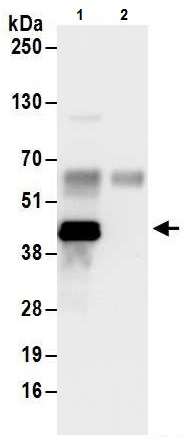 Immunoprecipitation - Anti-ADK antibody - C-terminal (AB226187)