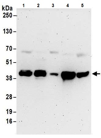 Western blot - Anti-ADK antibody - C-terminal (AB226187)