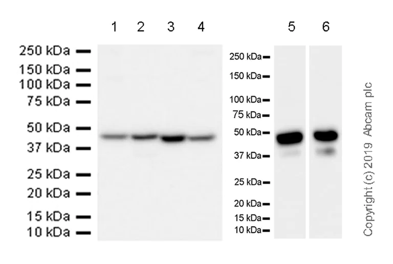 Western blot - Anti-ADK antibody [EPR23166-143] (AB243636)