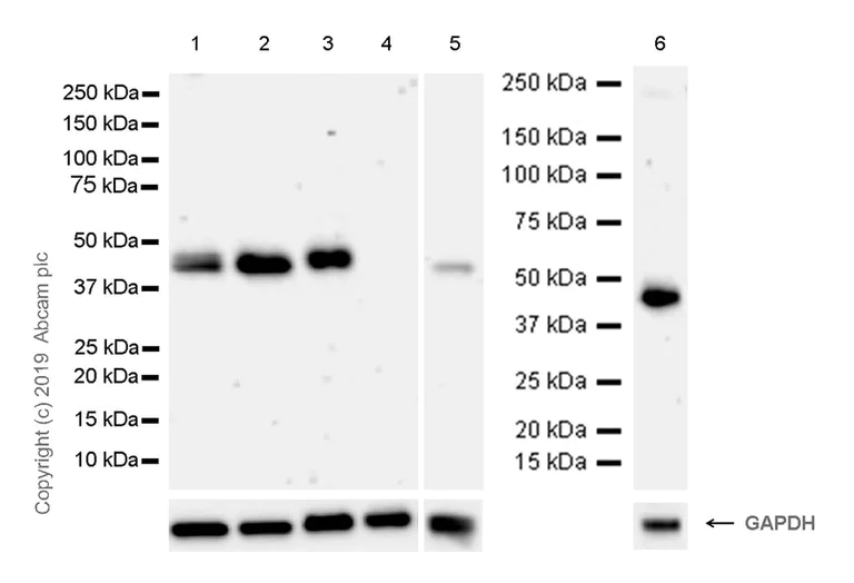 Western blot - Anti-ADK antibody [EPR23166-143] (AB243636)
