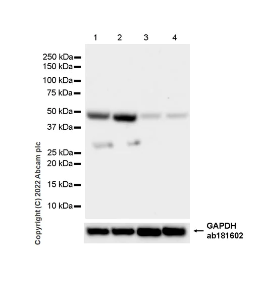 Western blot - Anti-ADK antibody [EPR27497-67] (AB307357)