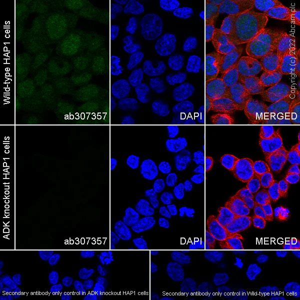 Immunocytochemistry/ Immunofluorescence - Anti-ADK antibody [EPR27497-67] - BSA and Azide free (AB307358)