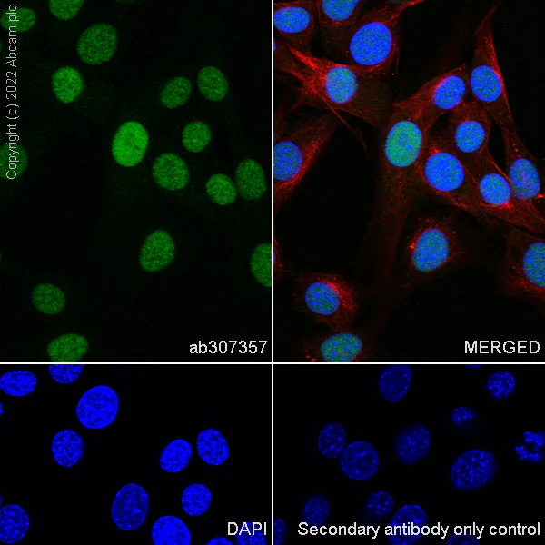 Immunocytochemistry/ Immunofluorescence - Anti-ADK antibody [EPR27497-67] - BSA and Azide free (AB307358)