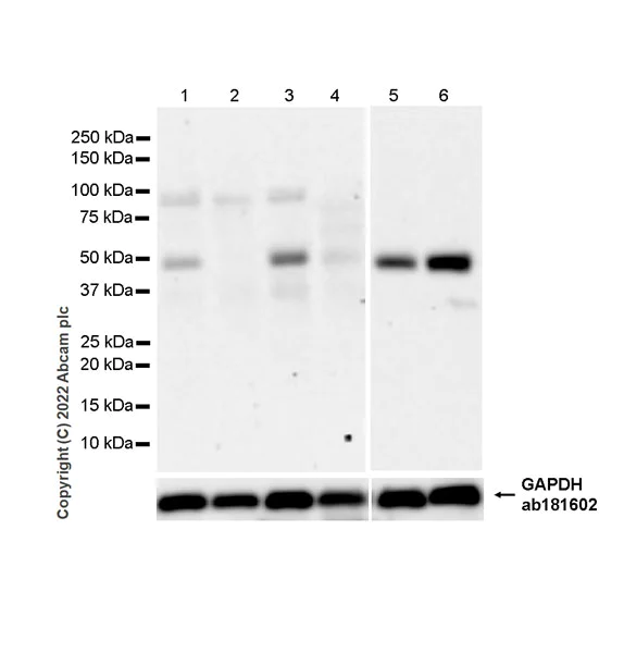 Western blot - Anti-ADK antibody [EPR27497-67] - BSA and Azide free (AB307358)