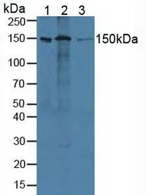 Western blot - Anti-ADNP antibody (AB231950)