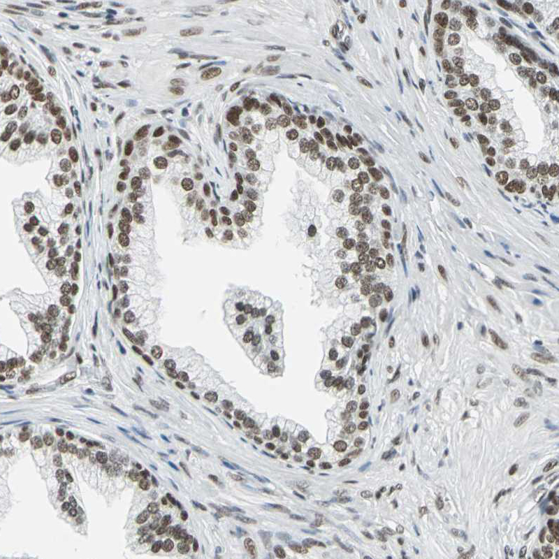Immunohistochemistry (Formalin/PFA-fixed paraffin-embedded sections) - Anti-ADNP antibody (AB244286)