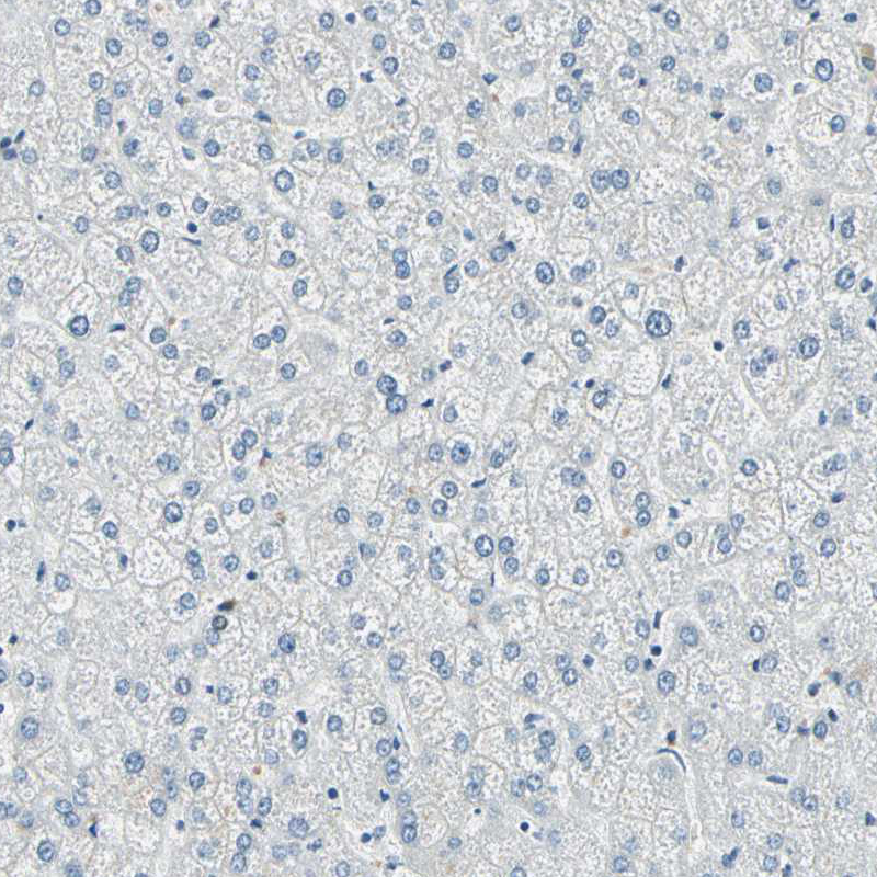 Immunohistochemistry (Formalin/PFA-fixed paraffin-embedded sections) - Anti-ADNP antibody (AB244286)