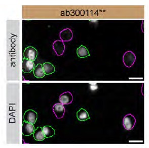 Immunocytochemistry/ Immunofluorescence - Anti-ADNP antibody [EPR25434-4] (AB300114), expandable thumbnail