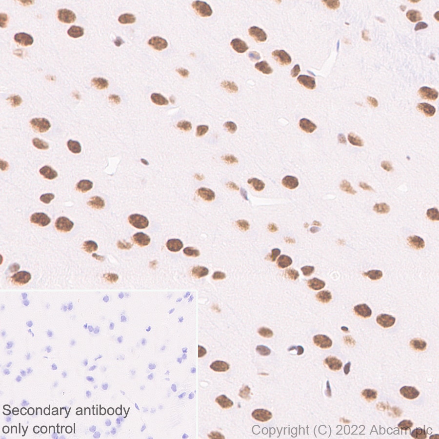 Immunohistochemistry (Formalin/PFA-fixed paraffin-embedded sections) - Anti-ADNP antibody [EPR25434-4] (ab300114), expandable thumbnail
