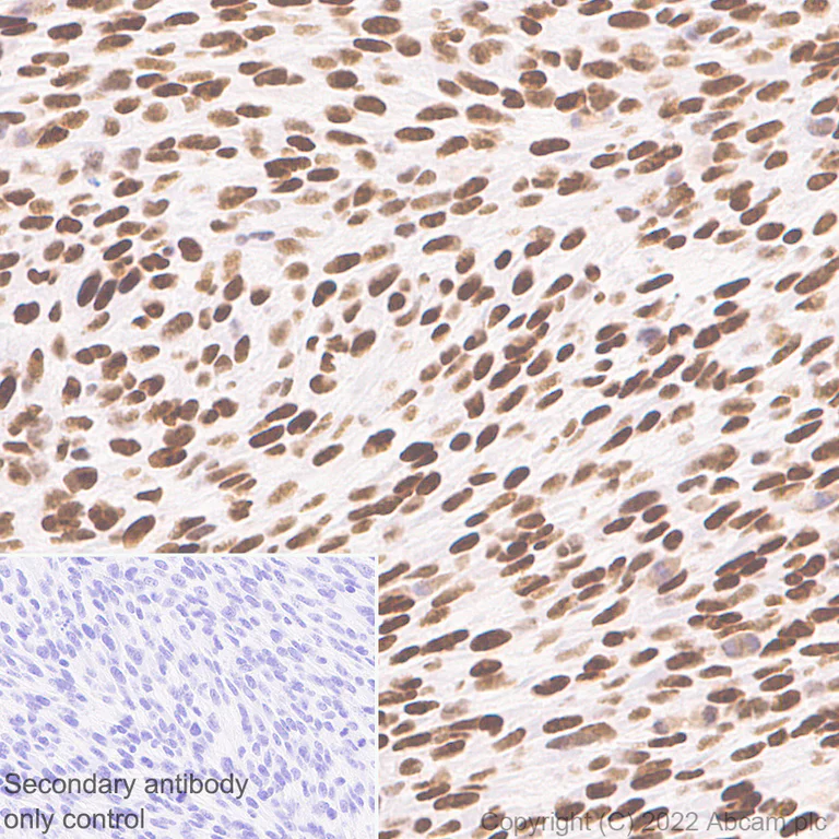 Immunohistochemistry (Formalin/PFA-fixed paraffin-embedded sections) - Anti-ADNP antibody [EPR25434-4] (AB300114)