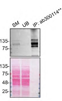 Immunoprecipitation - Anti-ADNP antibody [EPR25434-4] (AB300114), expandable thumbnail