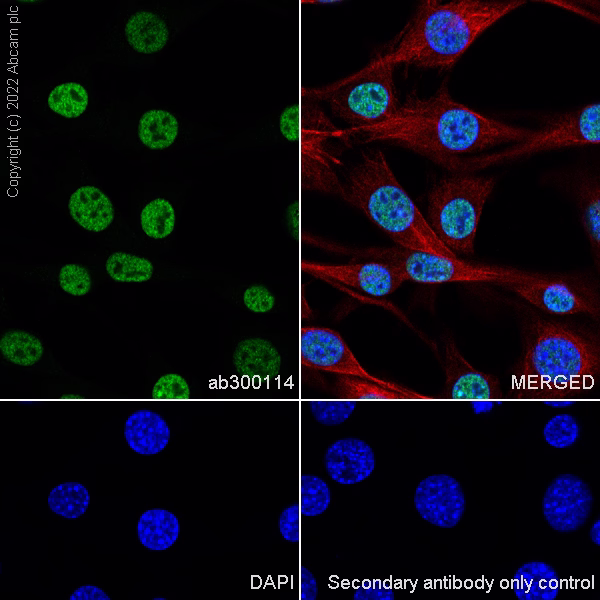 Immunocytochemistry - Anti-ADNP antibody [EPR25434-4] - BSA and Azide free (ab300115), expandable thumbnail