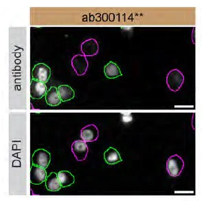 Immunocytochemistry/ Immunofluorescence - Anti-ADNP antibody [EPR25434-4] - BSA and Azide free (AB300115)