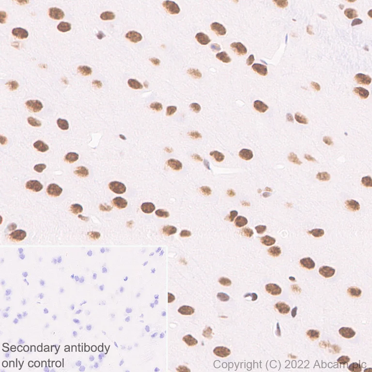 Immunohistochemistry (Formalin/PFA-fixed paraffin-embedded sections) - Anti-ADNP antibody [EPR25434-4] - BSA and Azide free (AB300115)