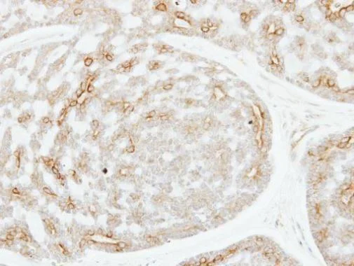 Immunohistochemistry (Formalin/PFA-fixed paraffin-embedded sections) - Anti-ADPGK antibody (AB228633)