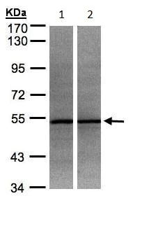 Western blot - Anti-ADPGK antibody (AB228633)