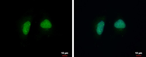 Immunocytochemistry/ Immunofluorescence - Anti-ADPRHL1 antibody (AB229252), expandable thumbnail