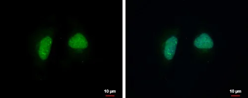 Immunocytochemistry/ Immunofluorescence - Anti-ADPRHL1 antibody (AB229252)