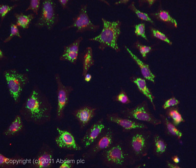 Immunocytochemistry/ Immunofluorescence - Anti-ADRA1B antibody (AB84405)