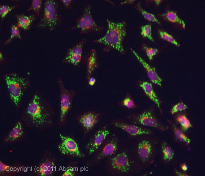 Immunocytochemistry/ Immunofluorescence - Anti-ADRA1B antibody (AB84405)