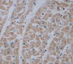 Immunohistochemistry (Formalin/PFA-fixed paraffin-embedded sections) - Anti-ADRA1B antibody (AB84405)