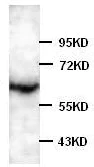 Western blot - Anti-ADRA1B antibody (AB84405)