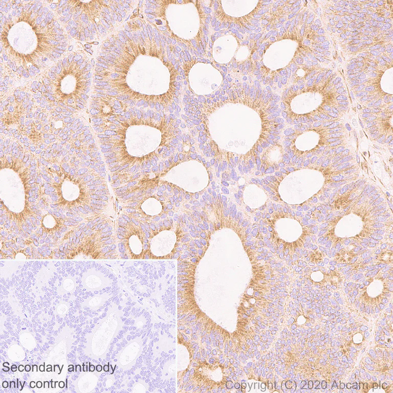 Immunohistochemistry (Formalin/PFA-fixed paraffin-embedded sections) - Anti-ADRA1B antibody [EPR10336] (AB169523)