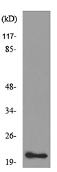 Western blot - Anti-Adrenomedullin/ADM antibody (AB190819)
