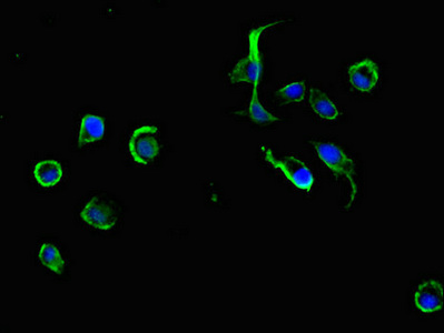 Immunocytochemistry/ Immunofluorescence - Anti-ADRM1/ARM-1 antibody (AB236774), expandable thumbnail