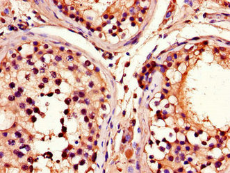 Immunohistochemistry (Formalin/PFA-fixed paraffin-embedded sections) - Anti-ADRM1/ARM-1 antibody (AB236774), expandable thumbnail