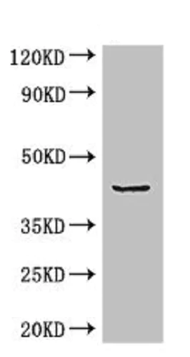 Western blot - Anti-ADRM1/ARM-1 antibody (AB236774)