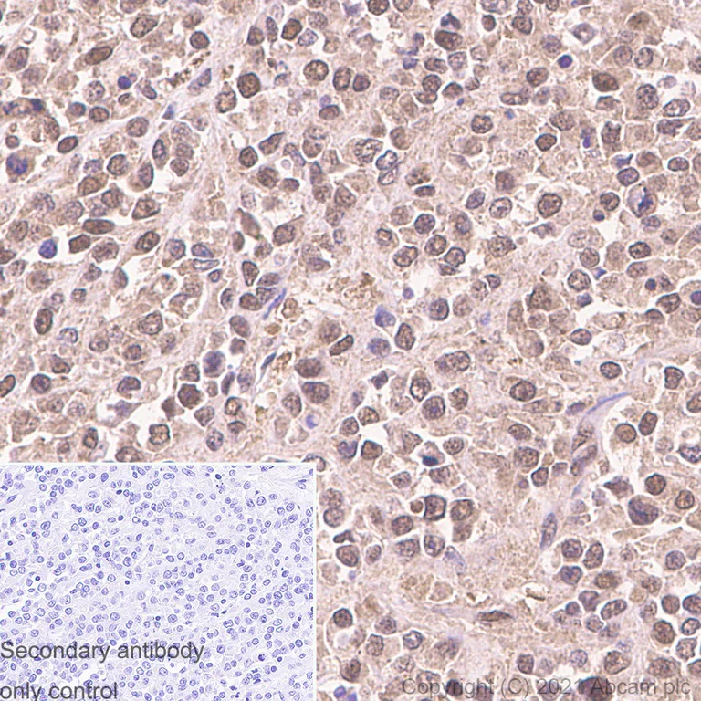 Immunohistochemistry (Formalin/PFA-fixed paraffin-embedded sections) - Anti-ADRM1/ARM-1 antibody [EPR11449(B)] (AB157185)
