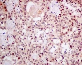 Immunohistochemistry (Formalin/PFA-fixed paraffin-embedded sections) - Anti-ADRM1/ARM-1 antibody [EPR11450(B)] (AB157218)