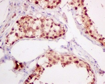 Immunohistochemistry (Formalin/PFA-fixed paraffin-embedded sections) - Anti-ADRM1/ARM-1 antibody [EPR11450(B)] (AB157218)