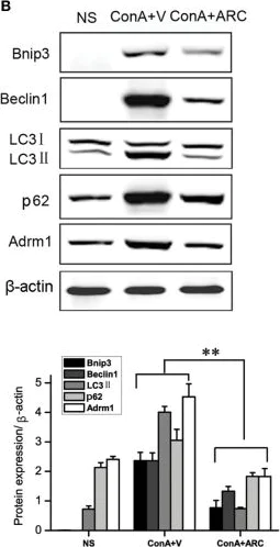 Western blot - Anti-ADRM1/ARM-1 antibody [EPR11450(B)] (AB157218)
