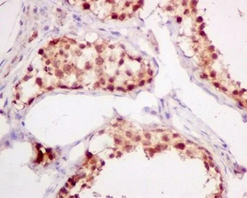 Immunohistochemistry (Formalin/PFA-fixed paraffin-embedded sections) - Anti-ADRM1/ARM-1 antibody [EPR11450(B)] - BSA and Azide free (AB249319)