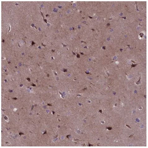 Immunohistochemistry (Formalin/PFA-fixed paraffin-embedded sections) - Anti-Adropin antibody (AB122800)