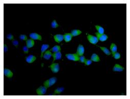 Immunocytochemistry/ Immunofluorescence - Anti-AdSS 2 antibody [EPR12331-73] (AB174848)