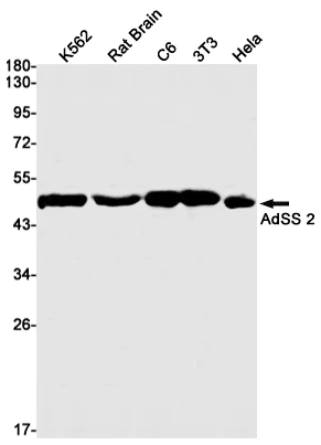 Western blot - Anti-AdSS 2 Antibody [S05-8F8] (AB317380)