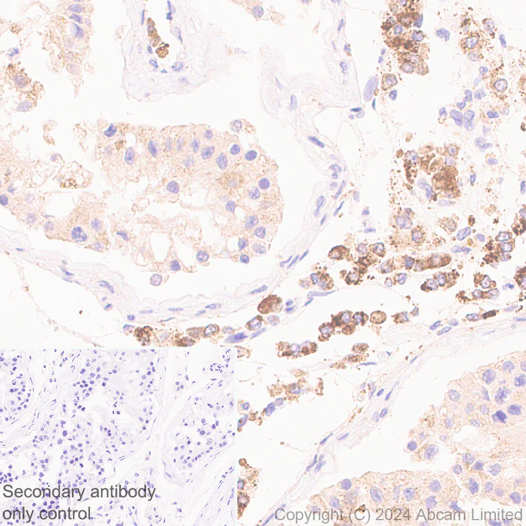 Immunohistochemistry (Formalin/PFA-fixed paraffin-embedded sections) - Anti-ADX antibody [EPR29804-54] - BSA and Azide free (AB321900)