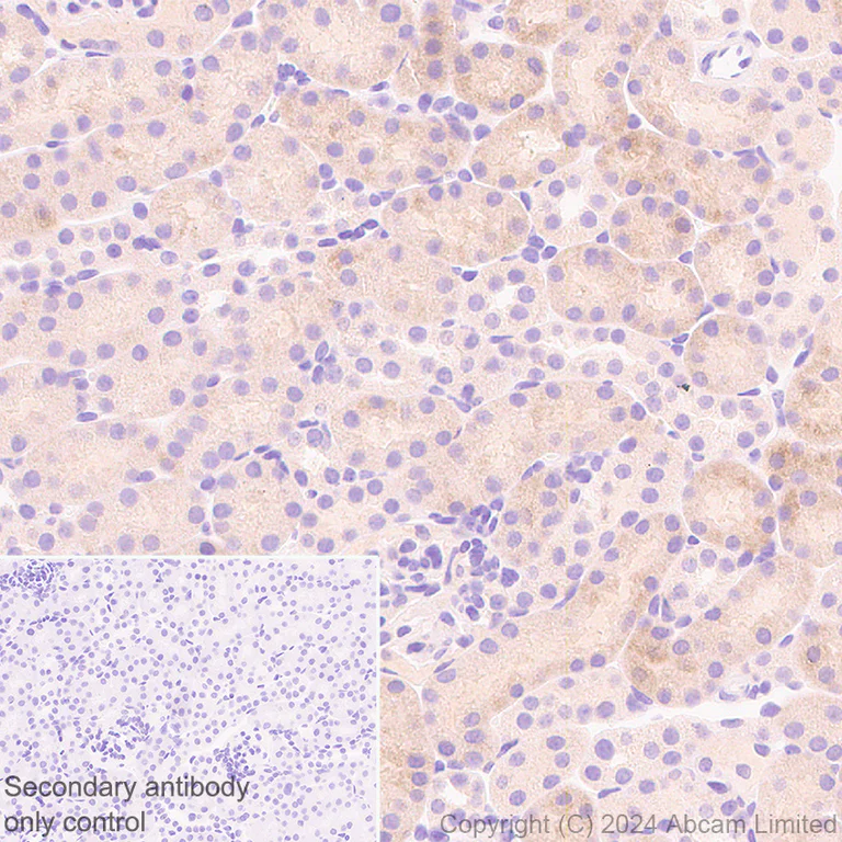 Immunohistochemistry (Formalin/PFA-fixed paraffin-embedded sections) - Anti-ADX antibody [EPR29804-54] - BSA and Azide free (AB321900)