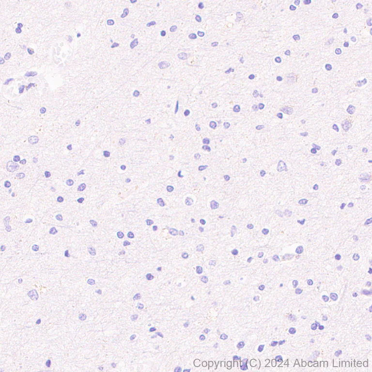 Immunohistochemistry (Formalin/PFA-fixed paraffin-embedded sections) - Anti-ADX antibody [EPR29804-54] - BSA and Azide free (AB321900)