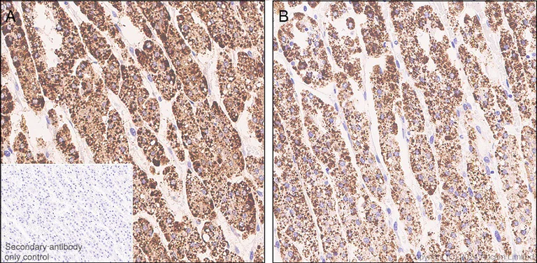 Immunohistochemistry (Formalin/PFA-fixed paraffin-embedded sections) - Anti-ADX antibody [EPR29804-54] - BSA and Azide free (AB321900)